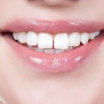 ASTRO TIPS FOR TEETH